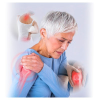 Чому варто приймати хондроїтин, глюкозамін і MSM разом